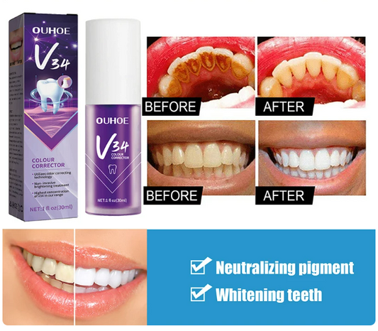 • Magic Teeth Cleaning Gel in 30 Seconds 50ml